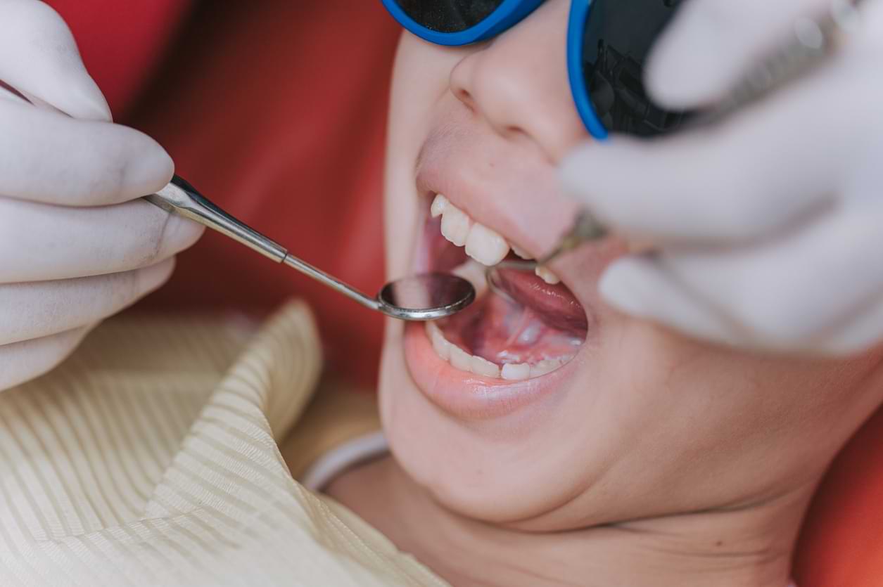 Why Do Root Canals Cost So Much? | Melbourne Dental Studio